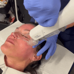korean-mesotherapy-treatment korean-mesotherapy-treatment