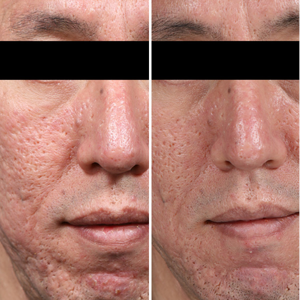 Potenza Before After2 Potenza Before After2